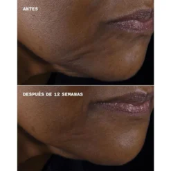 Clinique Smart Clinical Repair Firmeza + Lifting Para Rostro Y Cuello -Farmacia Quinta Legregranada Ventas clinique smart clinical repair lifting face neck cream 5