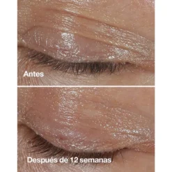 Clinique Smart Clinical Repair Wrinkle Correcting Eye Cream 10 Clinique Smart Clinical Repair Wrinkle Correcting Eye Cream -Farmacia Quinta Legregranada Ventas clinique smart clinical repair wrinkle correcting eye cream 2