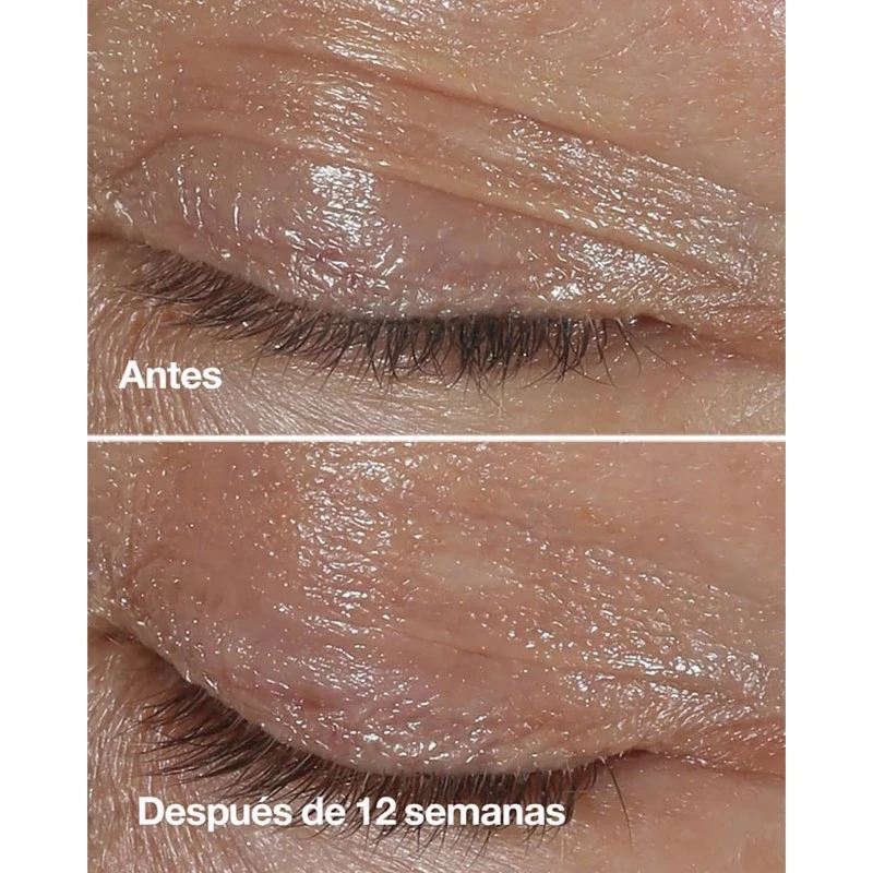 Clinique Smart Clinical Repair Wrinkle Correcting Eye Cream 3 Clinique Smart Clinical Repair Wrinkle Correcting Eye Cream - Imagen 3