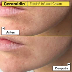 Dr. Jart+ Ceramidin Crema Infusionada Con Ectoína -Farmacia Quinta Legregranada Ventas dr jart ceramidin crema infusionada con ectoina 2
