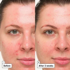 Dr. Jart+ Cicapair Tratamiento Altamente Calmante -Farmacia Quinta Legregranada Ventas dr jart cicapair tratamiento altamente calmante 2